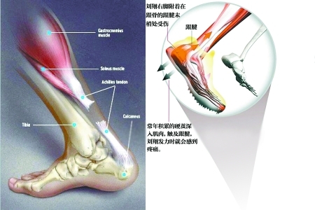 各种运动员职业生涯中的常见选择与难题 各种运动员职业生涯中的常见选择与难题